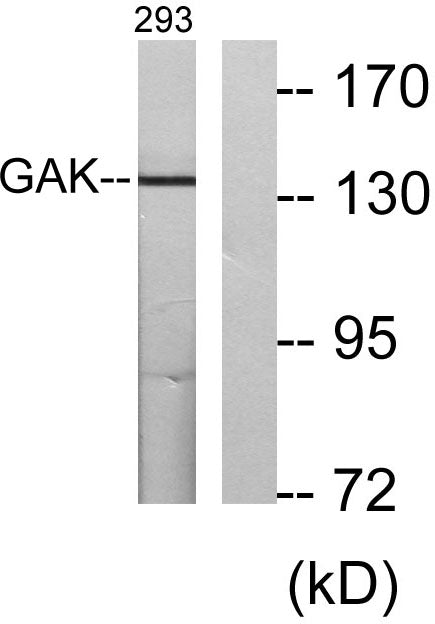 GAK Rabbit Polyclonal Antibody