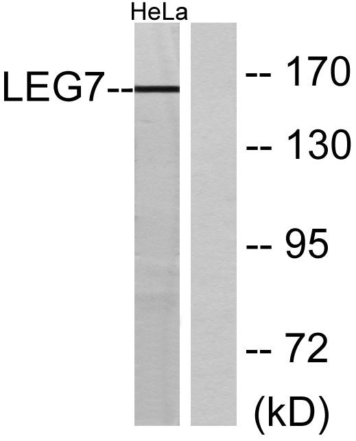 Galectin-7 Rabbit Polyclonal Antibody