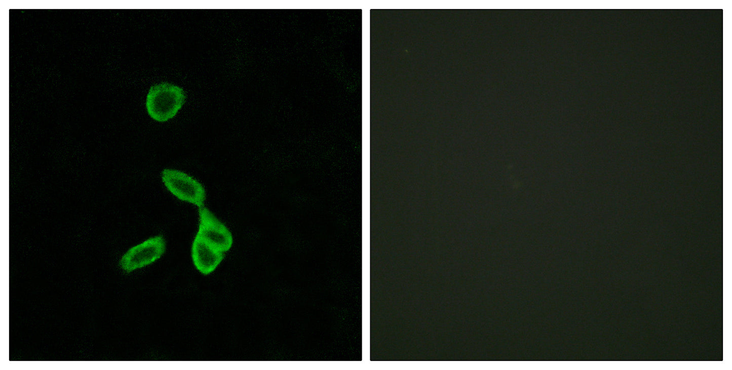 GALR1 Rabbit Polyclonal Antibody