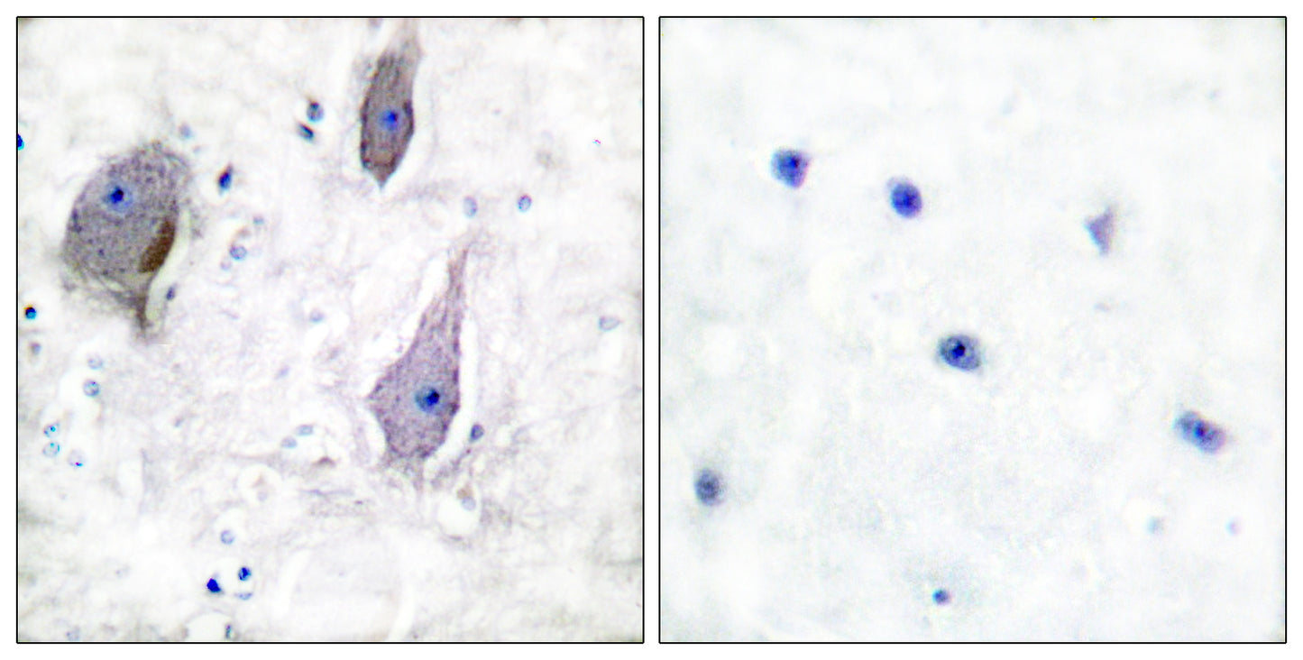 GAS3 Rabbit Polyclonal Antibody
