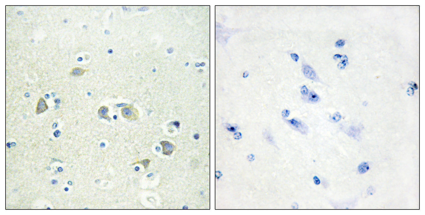 Gas6 Rabbit Polyclonal Antibody