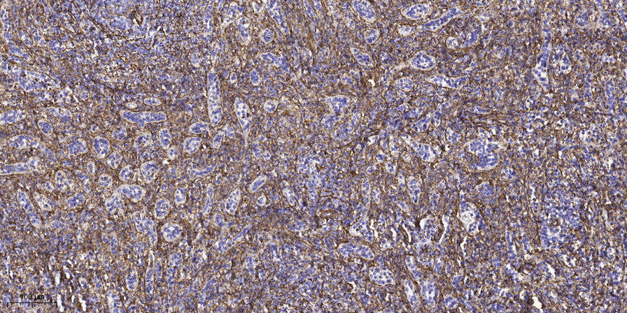 Gas8 Rabbit Polyclonal Antibody