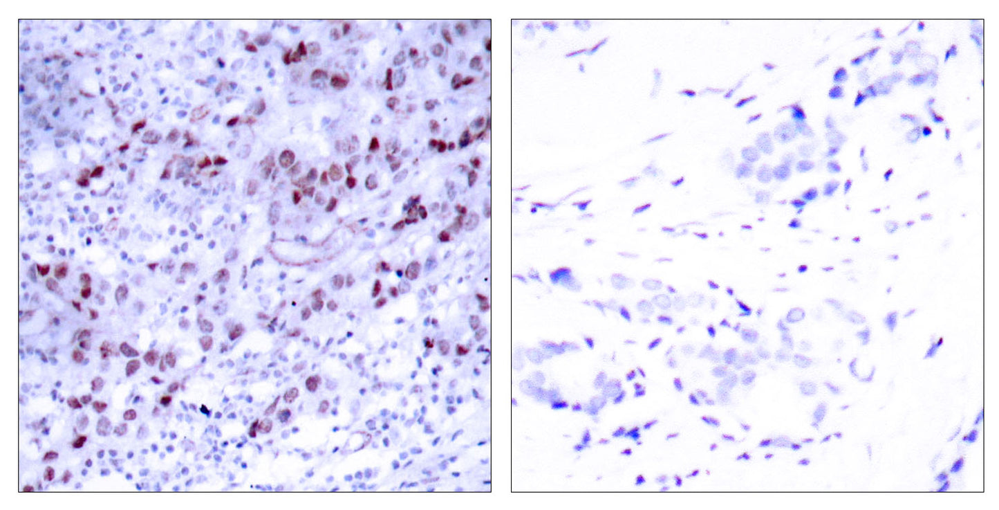 GATA-1 Rabbit Polyclonal Antibody