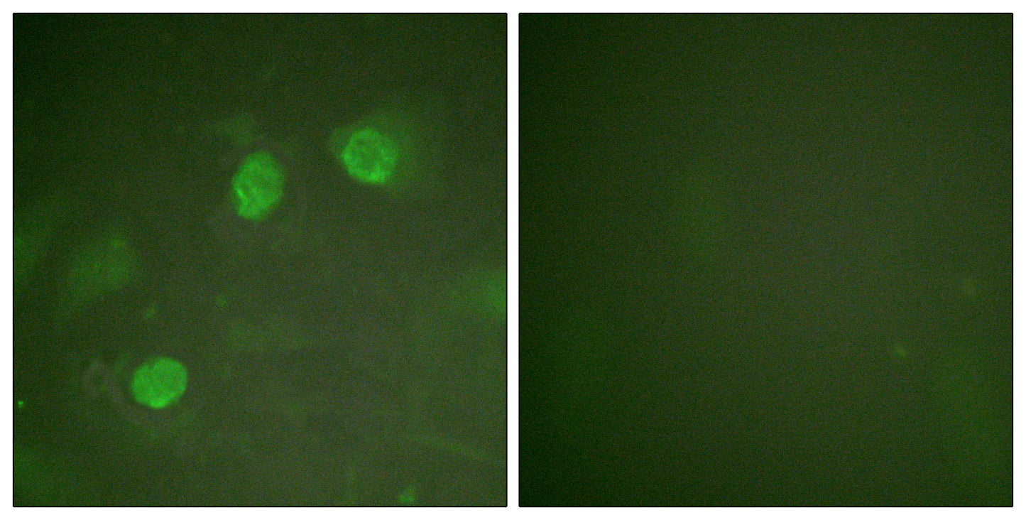 GATA-2/3 Rabbit Polyclonal Antibody
