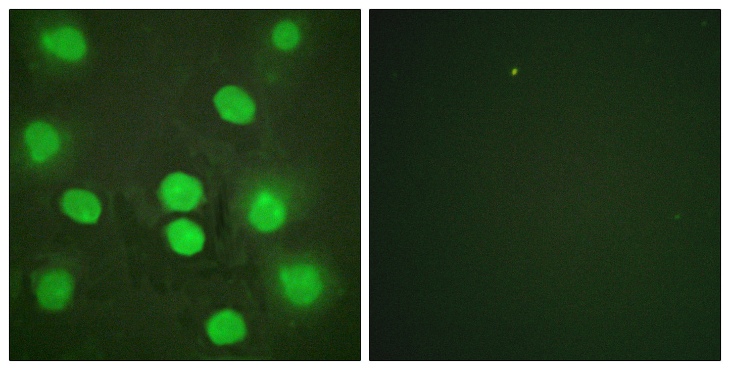 GATA-4 Rabbit Polyclonal Antibody