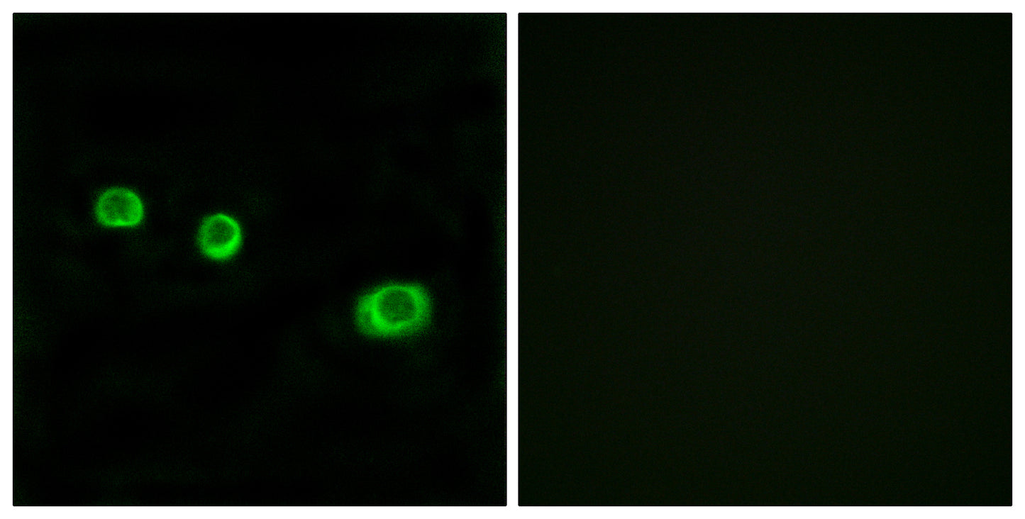 GBP1 Rabbit Polyclonal Antibody