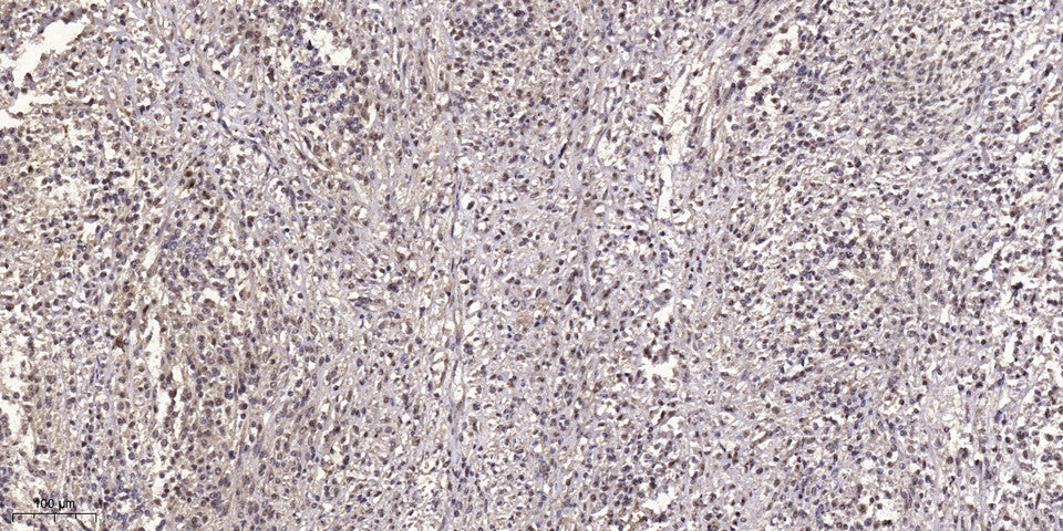 GBP5 Rabbit Polyclonal Antibody
