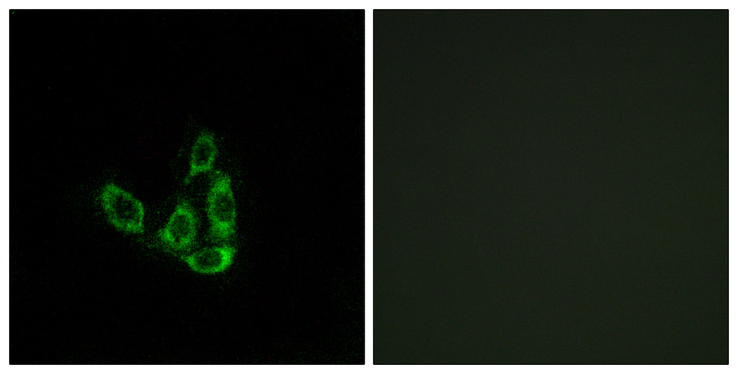 GCNT3 Rabbit Polyclonal Antibody