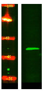 GCNT4 Rabbit Polyclonal Antibody