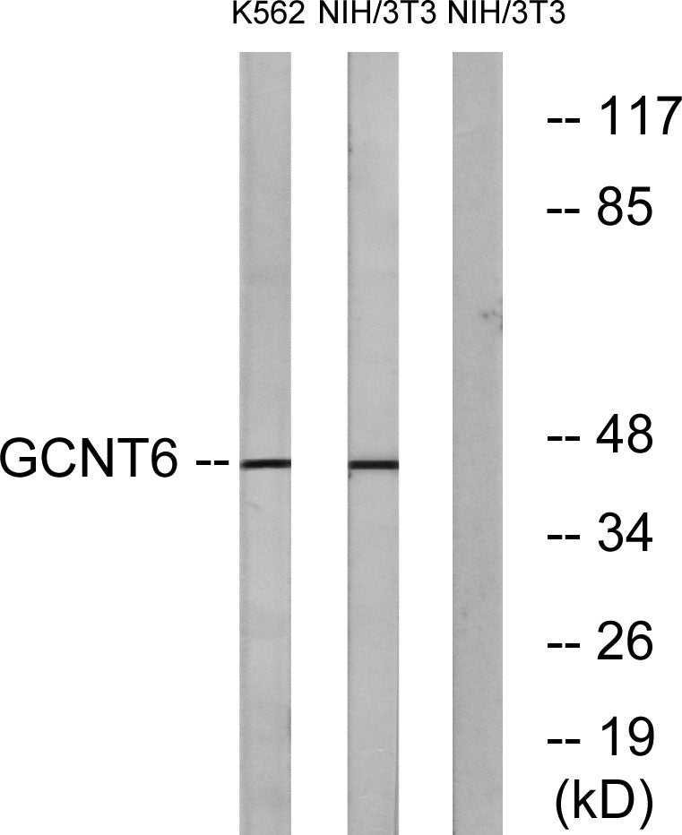 GCNT6 Rabbit Polyclonal Antibody