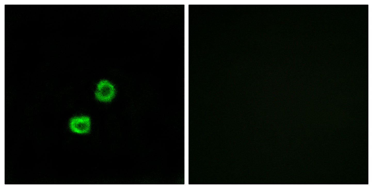 GCNT7 Rabbit Polyclonal Antibody