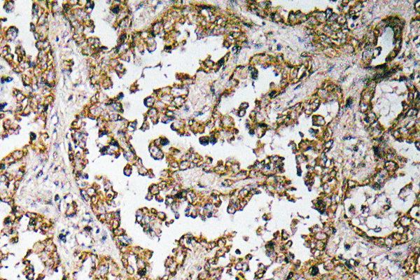 GDF-8 Rabbit Polyclonal Antibody