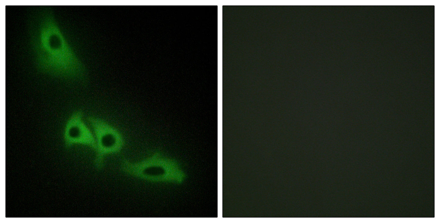 GK1 Rabbit Polyclonal Antibody
