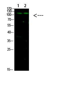 GLI-1 Rabbit Polyclonal Antibody