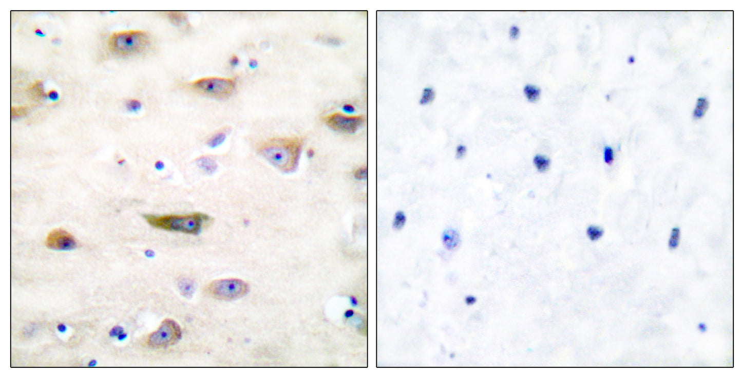 GluR-2 Rabbit Polyclonal Antibody