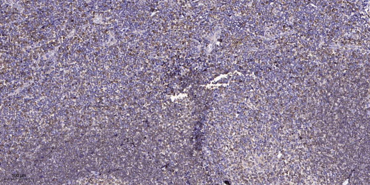GNG2 Rabbit Polyclonal Antibody