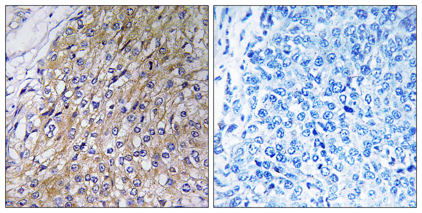 GOLT1A Rabbit Polyclonal Antibody