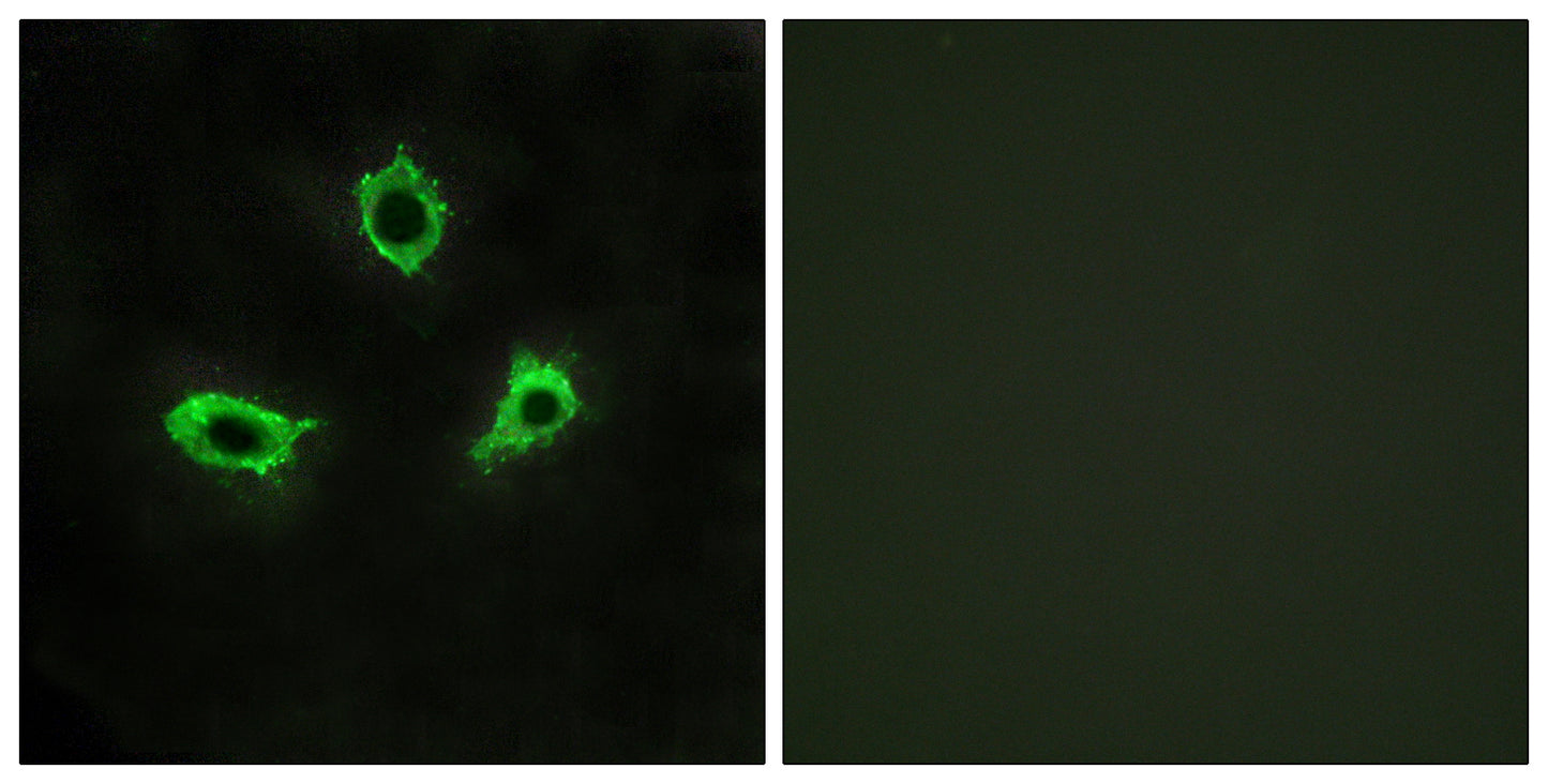 GPR115 Rabbit Polyclonal Antibody