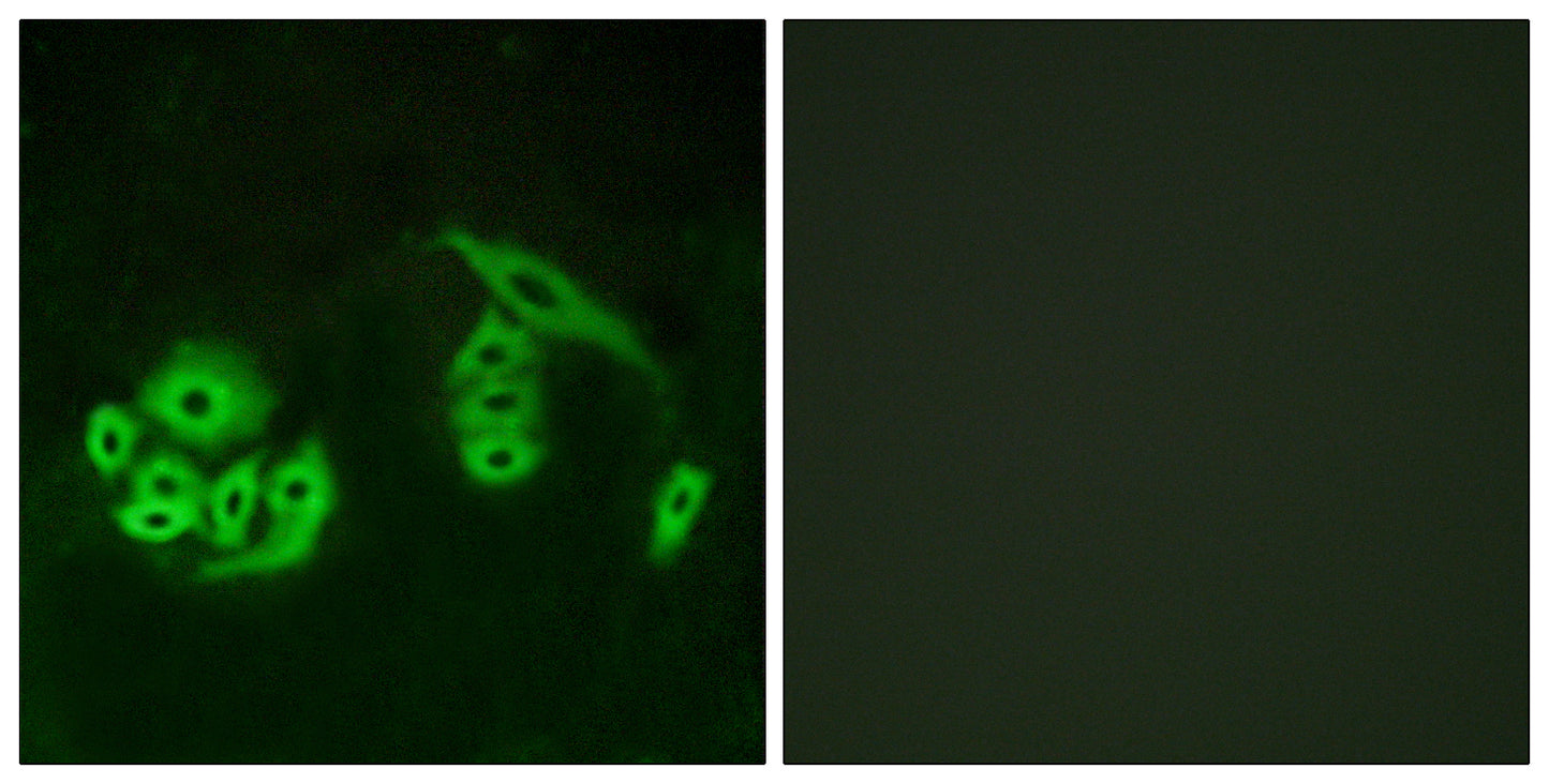 GPR12 Rabbit Polyclonal Antibody