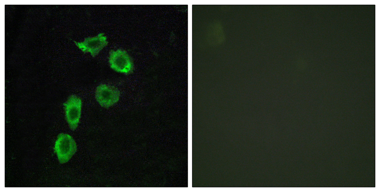 GPR123 Rabbit Polyclonal Antibody