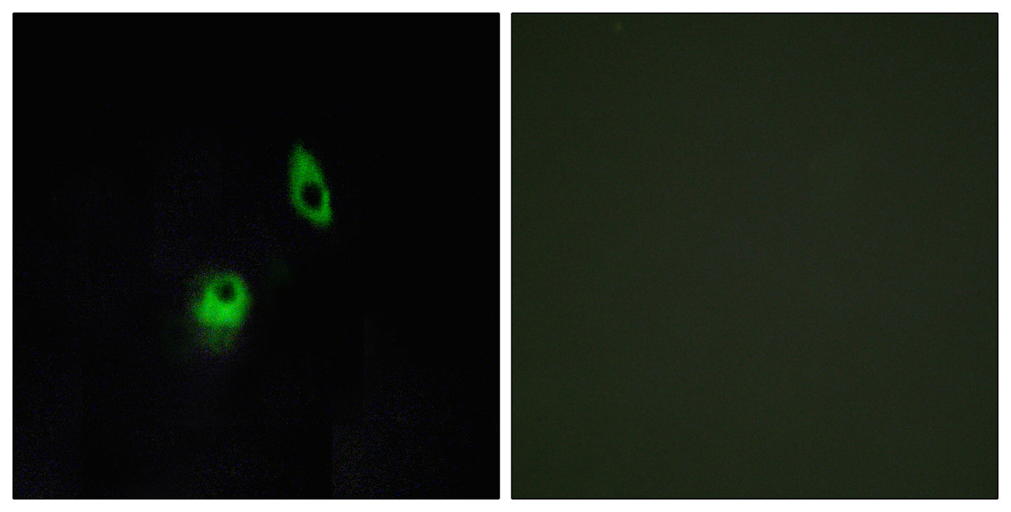 GPR124 Rabbit Polyclonal Antibody