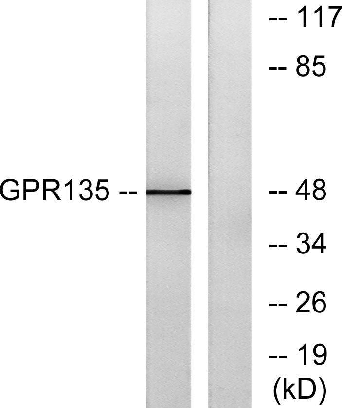 GPR135 Rabbit Polyclonal Antibody