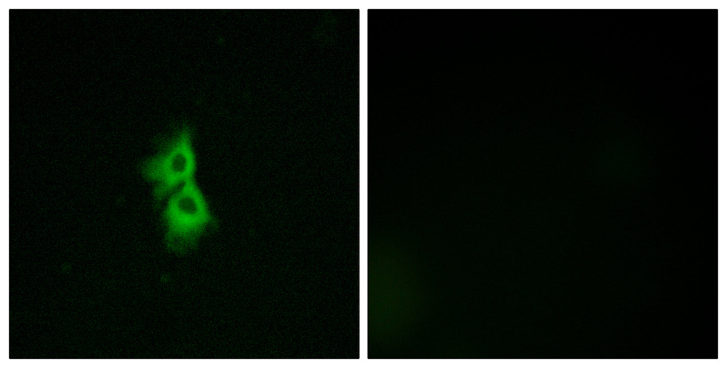 GPR22 Rabbit Polyclonal Antibody
