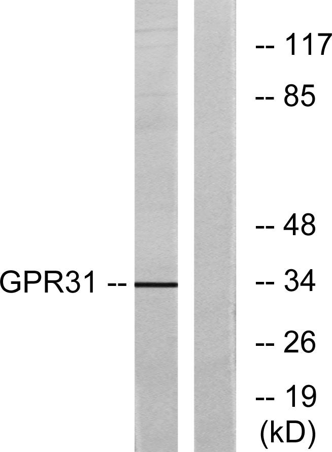 GPR31 Rabbit Polyclonal Antibody
