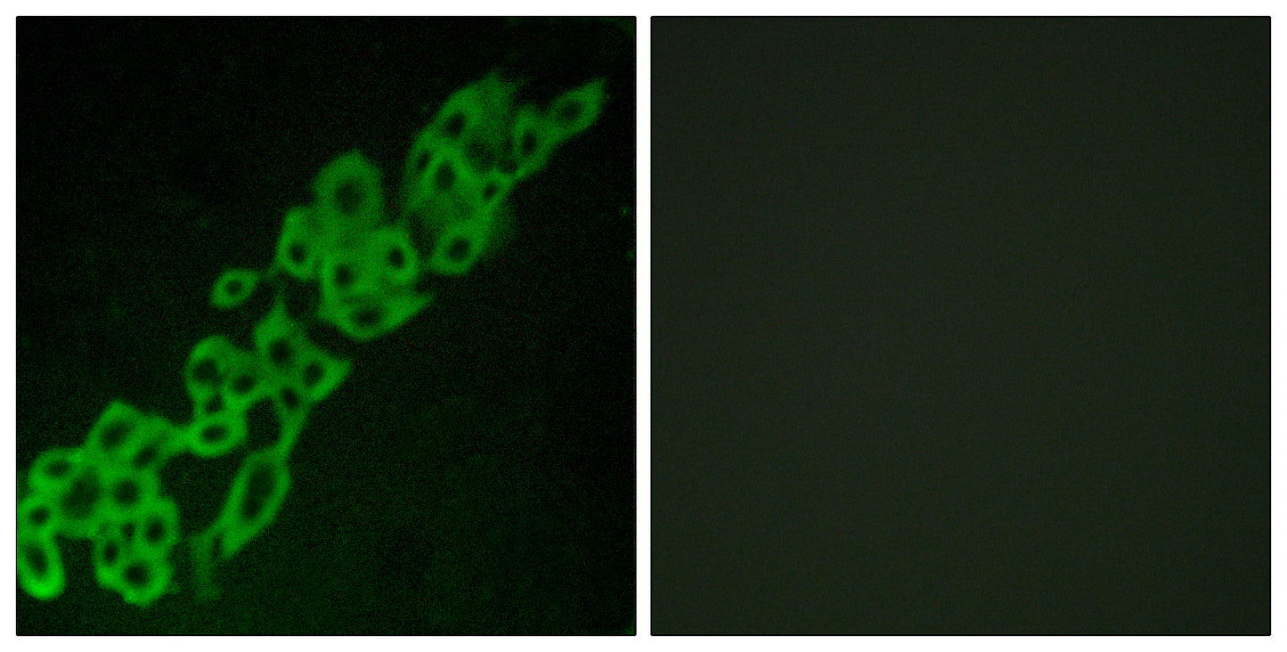GPR32 Rabbit Polyclonal Antibody