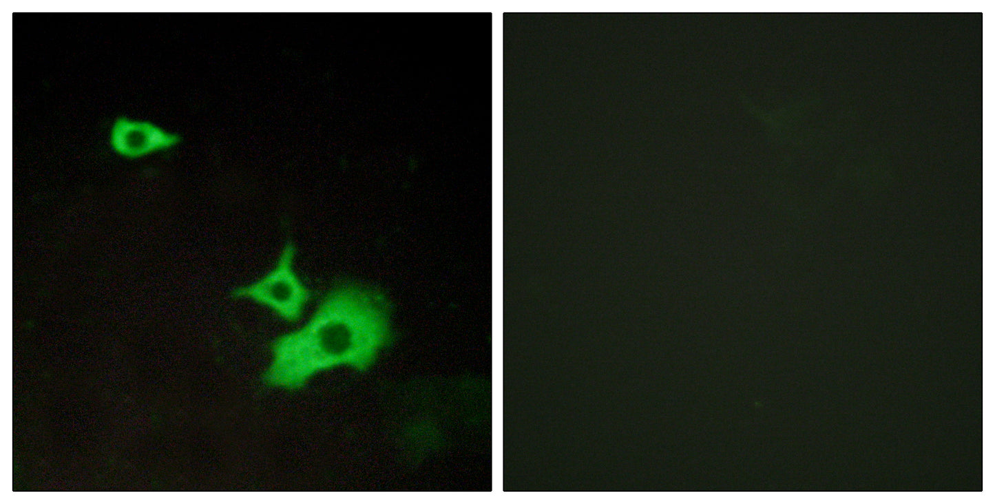 GPR37L1 Rabbit Polyclonal Antibody