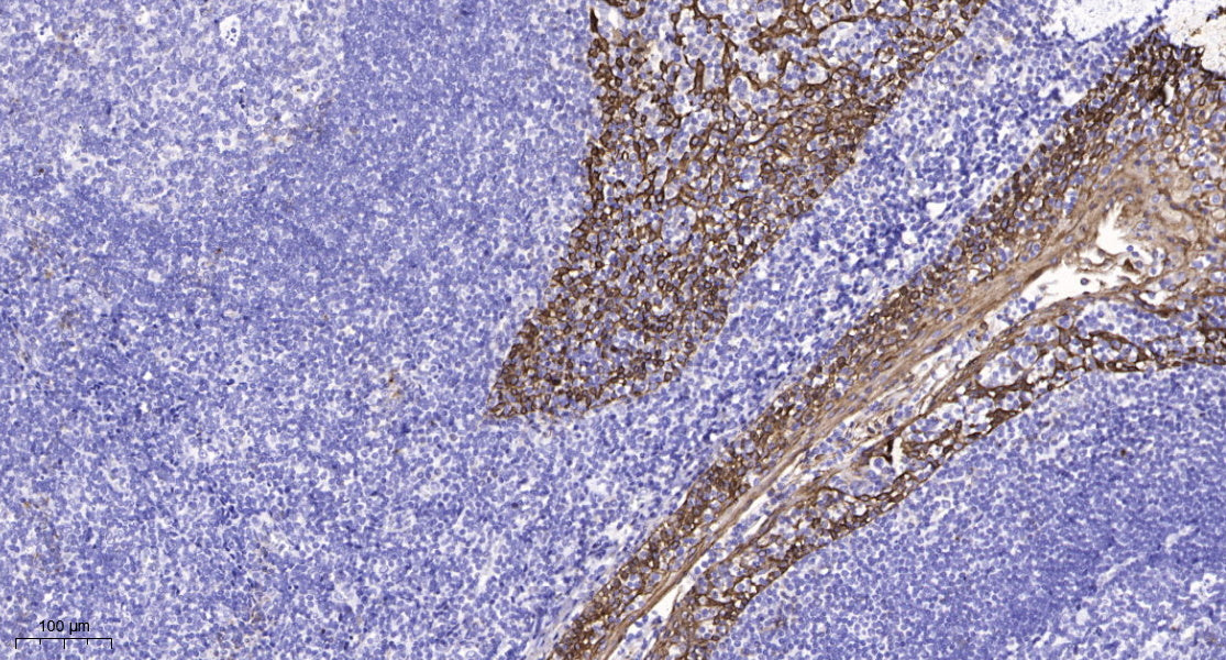 GPR98 Rabbit Polyclonal Antibody