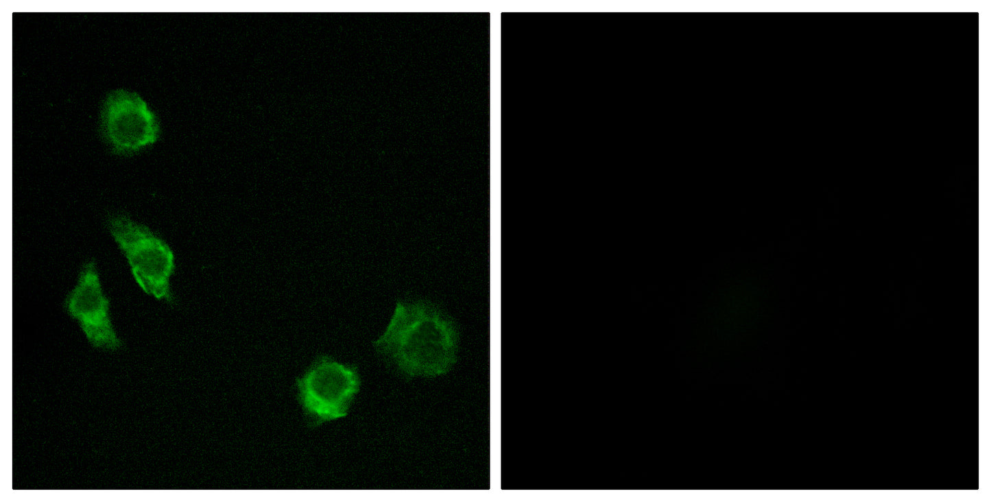 GPRC5D Rabbit Polyclonal Antibody