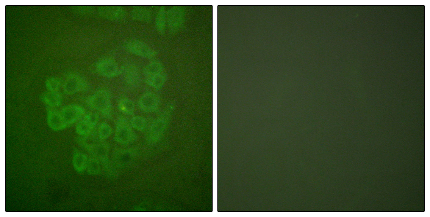 GR Rabbit Polyclonal Antibody
