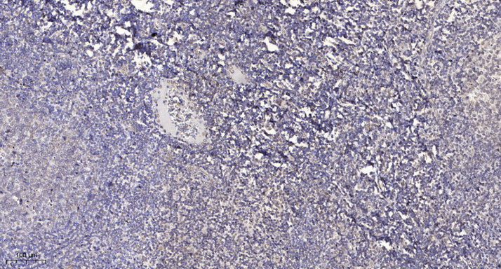 GRIF-1 Rabbit Polyclonal Antibody