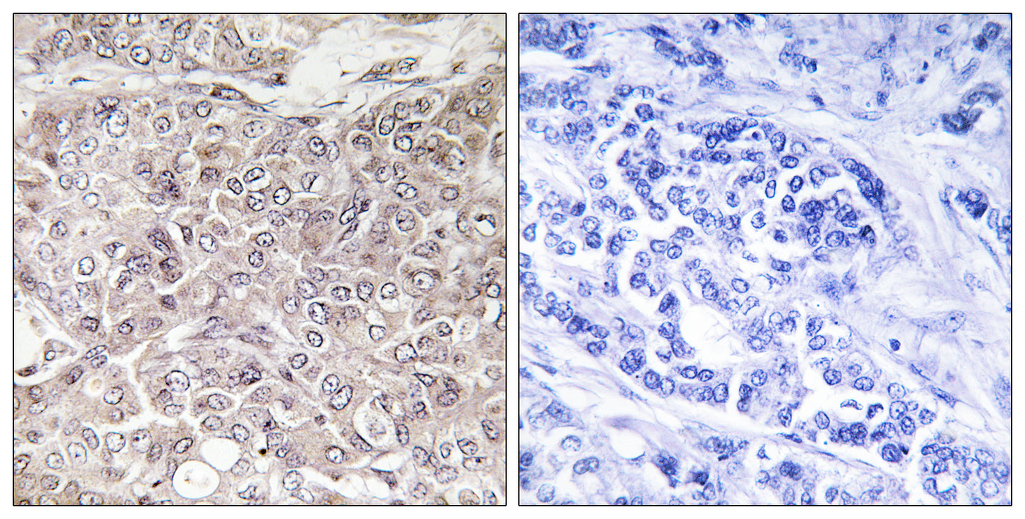 GRIN3 Rabbit Polyclonal Antibody