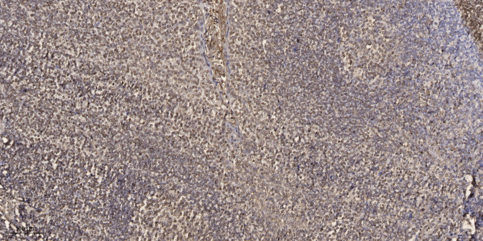 GRIP-1 Rabbit Polyclonal Antibody