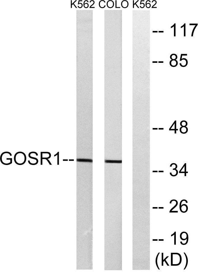 GS28 Rabbit Polyclonal Antibody