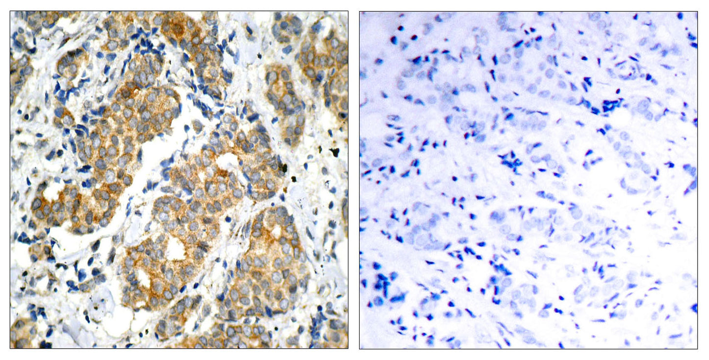 GSK3α Rabbit Polyclonal Antibody