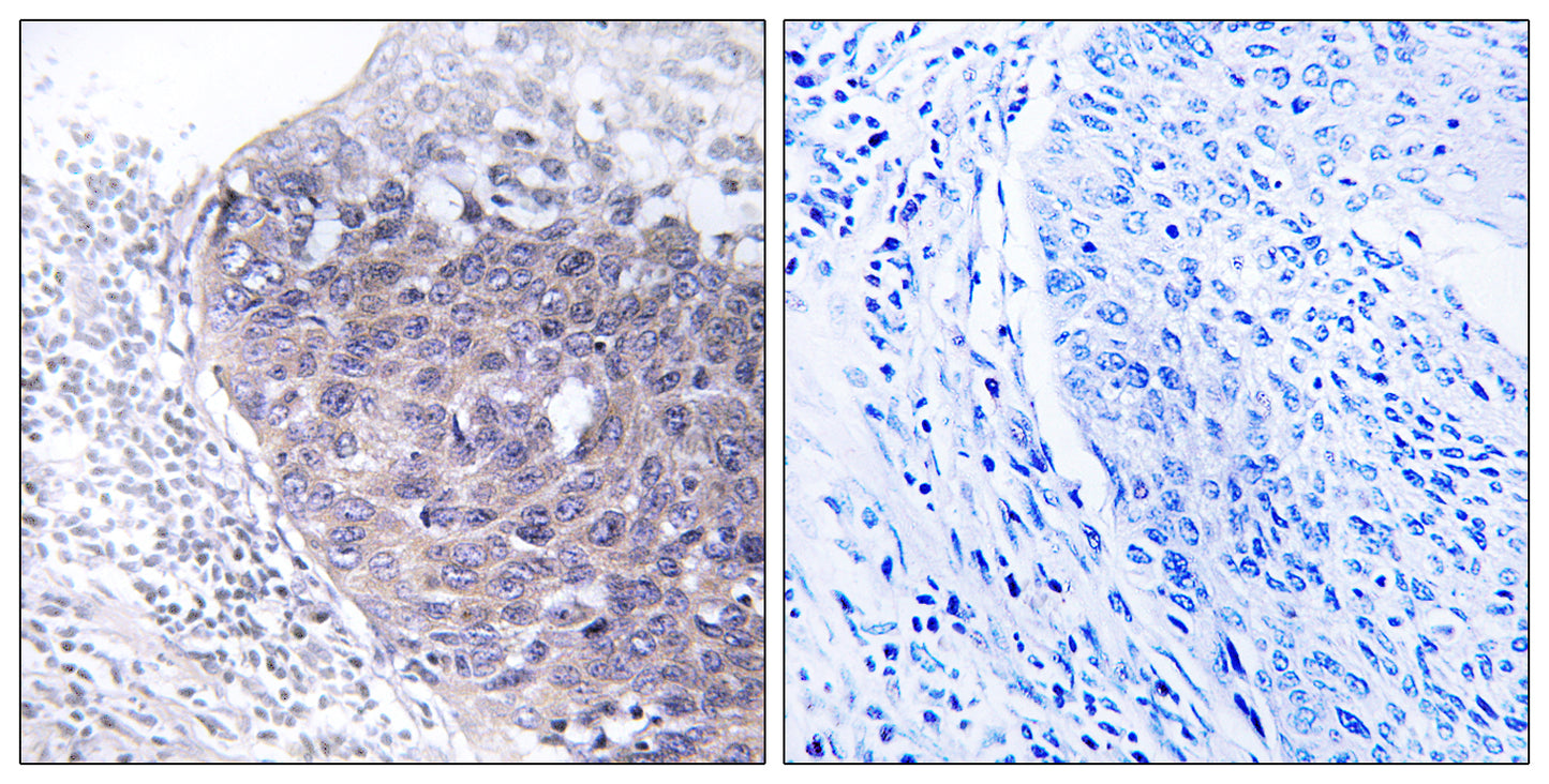 GTPBP5 Rabbit Polyclonal Antibody