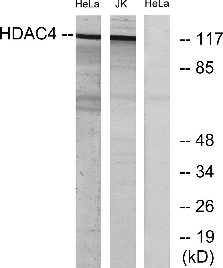 HDAC4 Rabbit Polyclonal Antibody