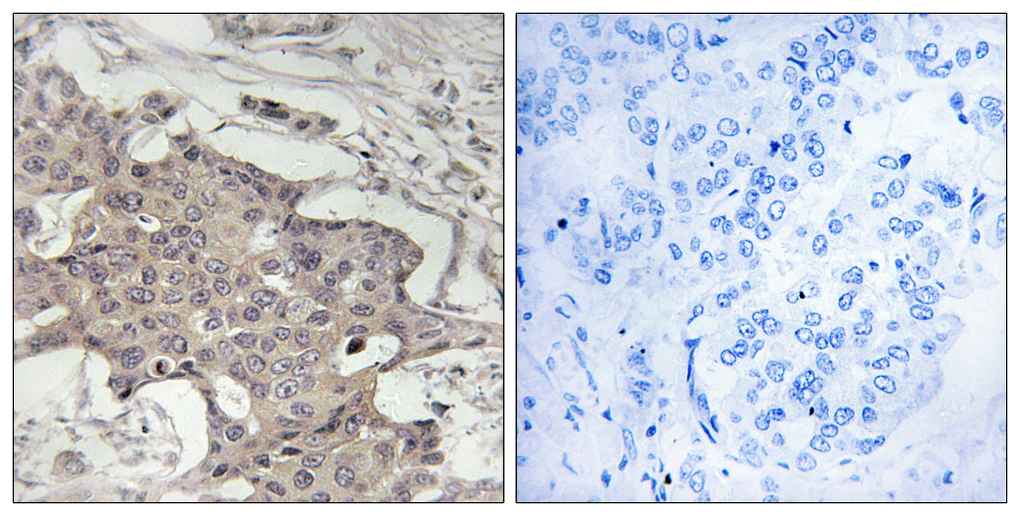 HIBADH Rabbit Polyclonal Antibody