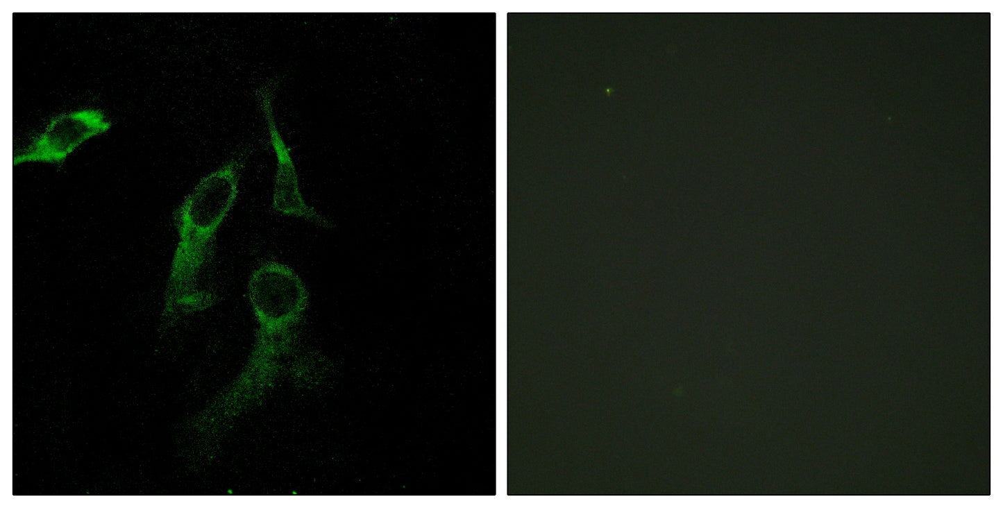 HisRS Rabbit Polyclonal Antibody