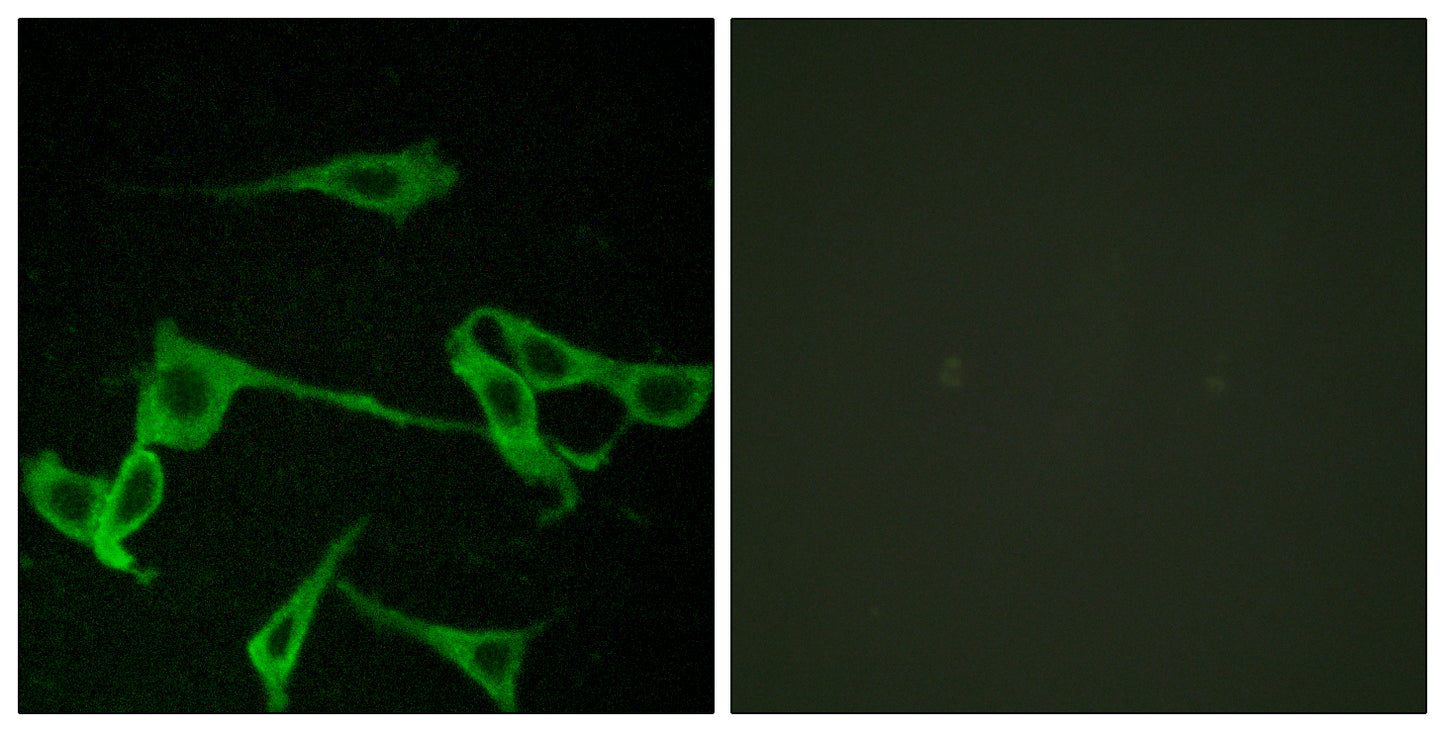 Histamine H2 Receptor Rabbit Polyclonal Antibody