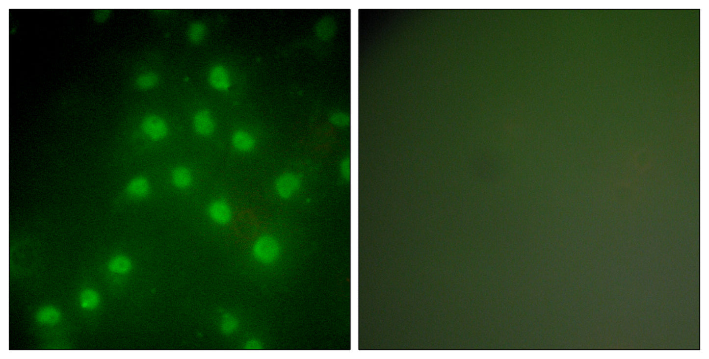 Histone deacetylase 9 Rabbit Polyclonal Antibody