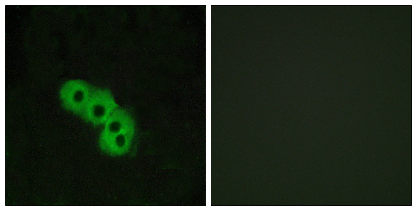 HM74 Rabbit Polyclonal Antibody