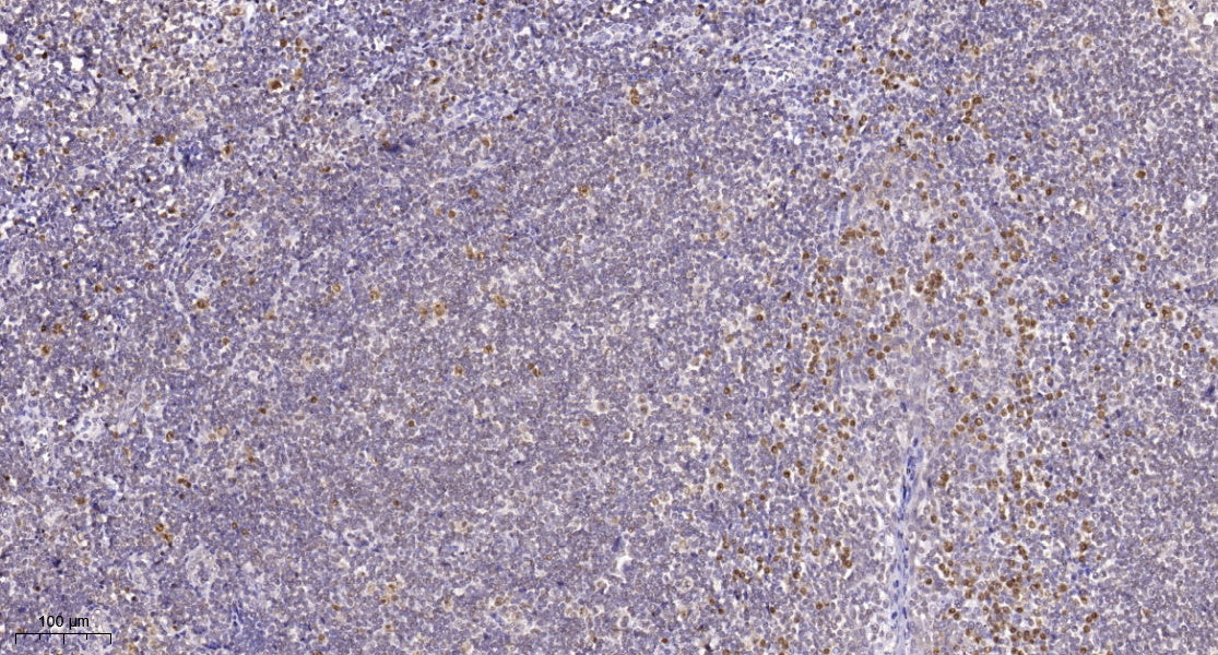 HMG-I/HMG-Y Rabbit Polyclonal Antibody