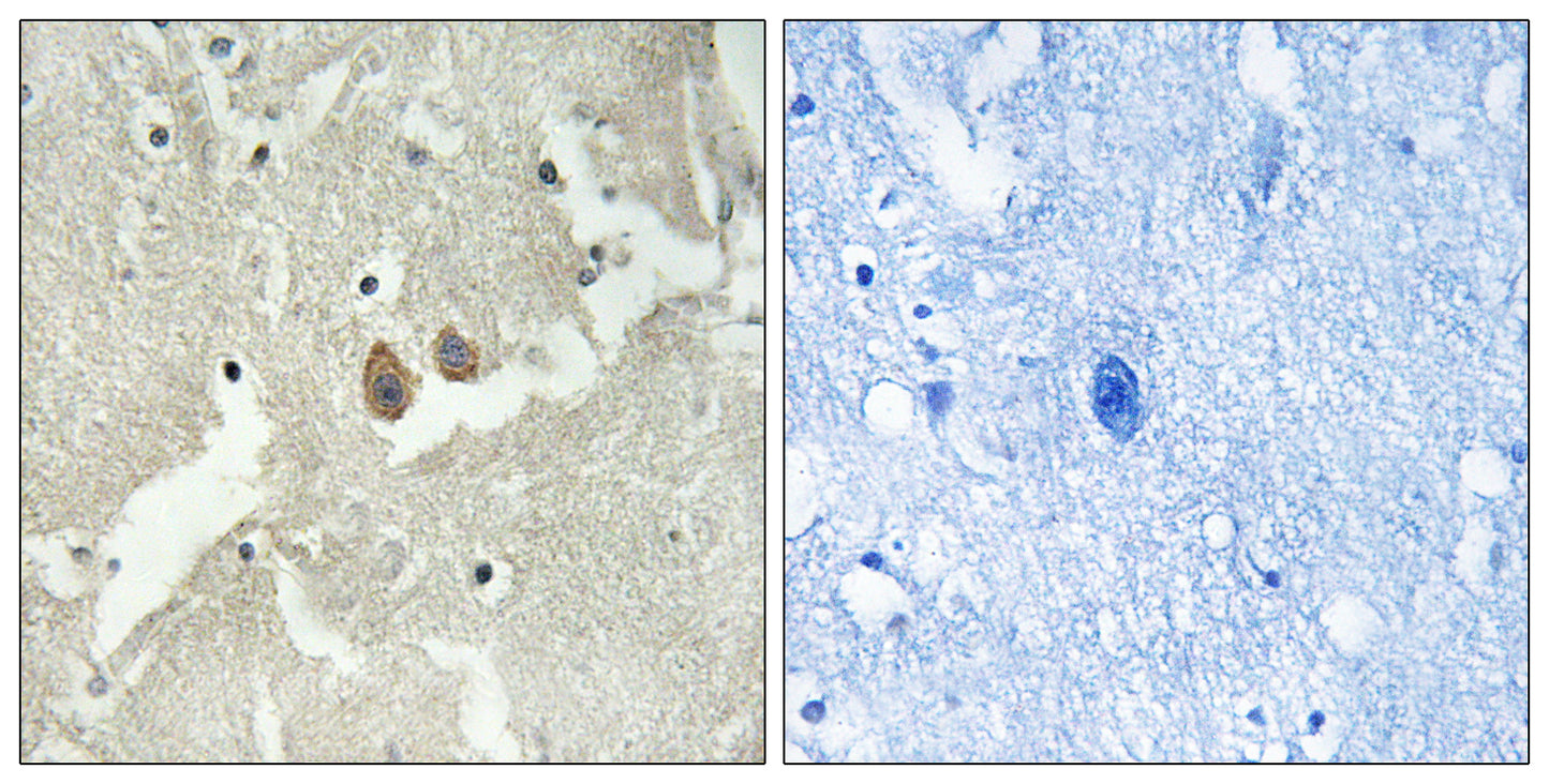 HMP19 Rabbit Polyclonal Antibody