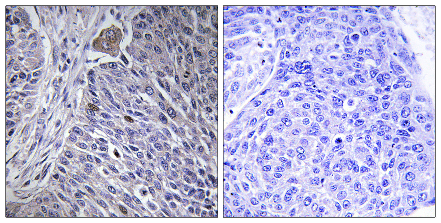 hnRNP DL Rabbit Polyclonal Antibody