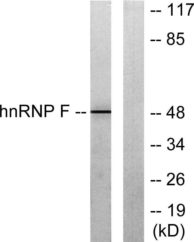 hnRNP F Rabbit Polyclonal Antibody