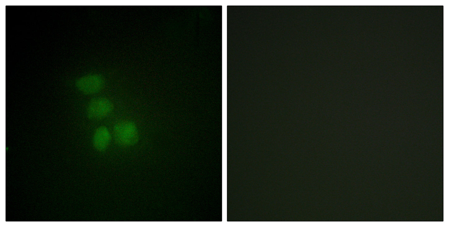 hnRNP G Rabbit Polyclonal Antibody